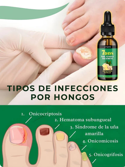7 DIAS ELIMINA HONGO