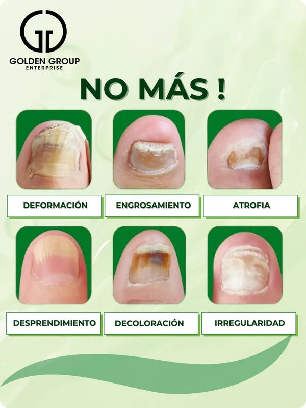 7 DIAS ELIMINA HONGO